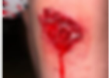 (alerta. imágenes sensibles) UN JOVEN DENUNCIO EN LAS REDES QUE CHOCARON A SU HERMANO Y EL CONDUCTOR DEL AUTO NO SE DETUVO