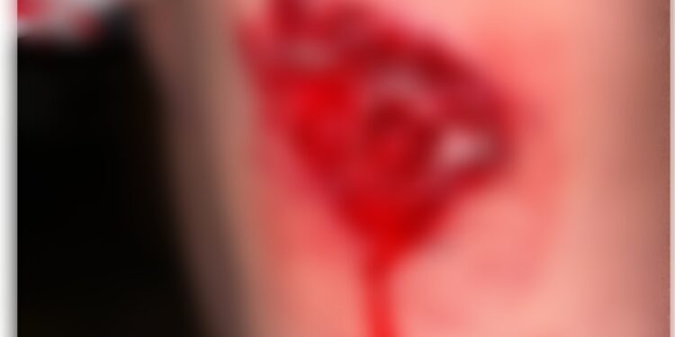 (alerta. imágenes sensibles) UN JOVEN DENUNCIO EN LAS REDES QUE CHOCARON A SU HERMANO Y EL CONDUCTOR DEL AUTO NO SE DETUVO